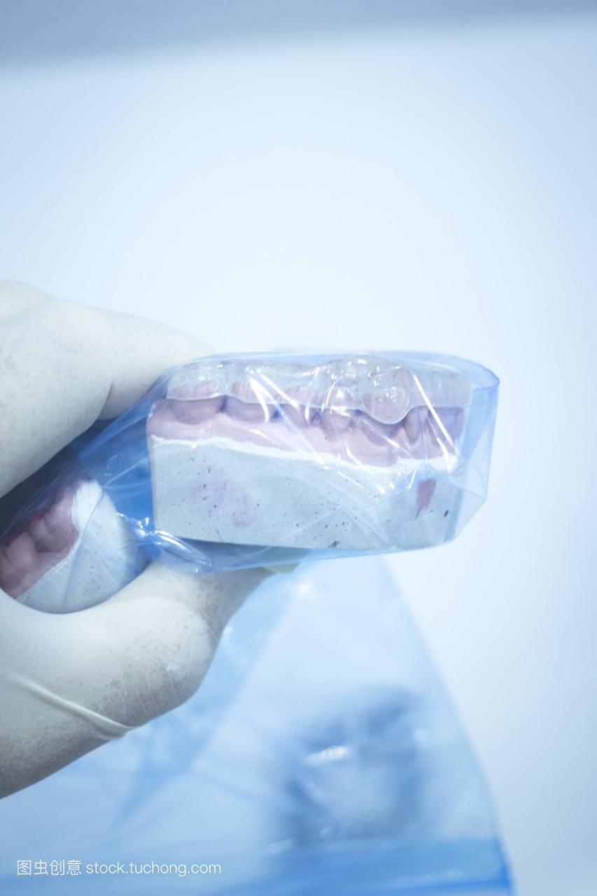 牙模牙医粘土牙齿陶瓷板铸造模型