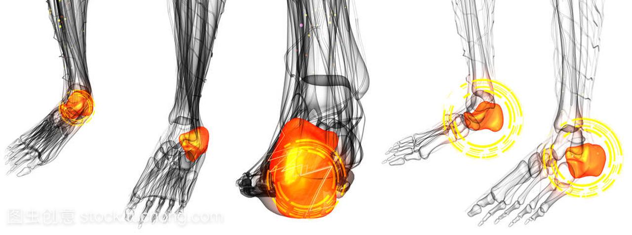 人类的脚关节疼痛三维渲染图