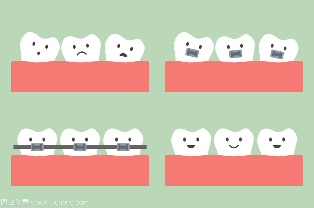 牙科正畸治疗与牙齿大括号