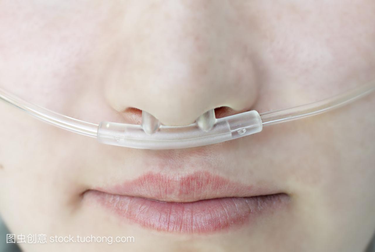 对病人的呼吸氧气鼻导管