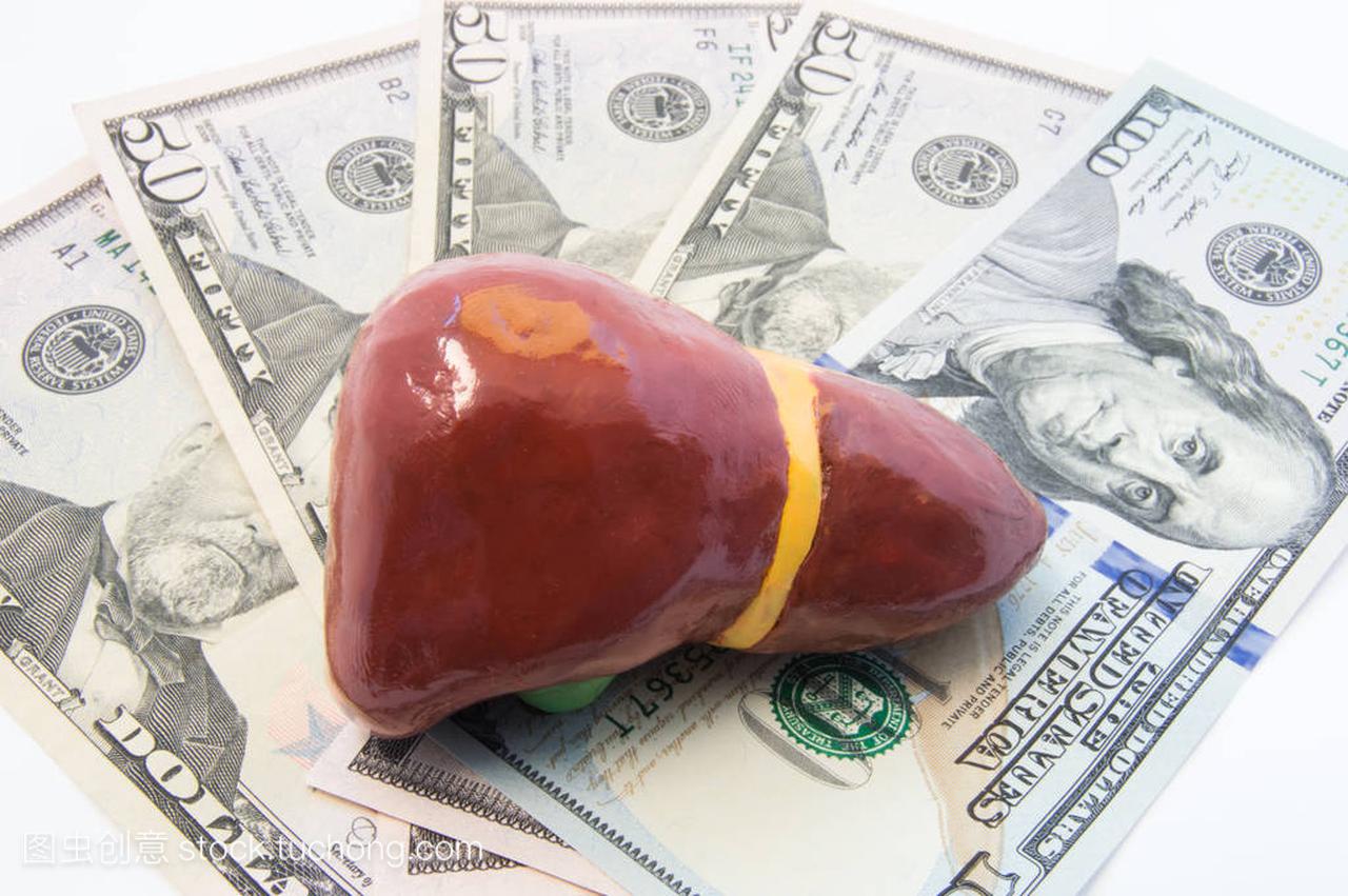 肝图躺在钱-美元纸币上。确定成本的治疗肝脏