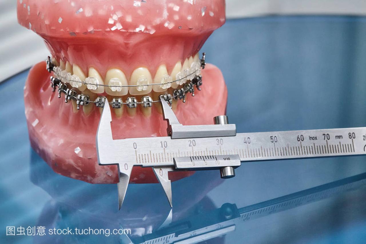 人类的下巴或牙齿模型金属有线的牙齿矫正
