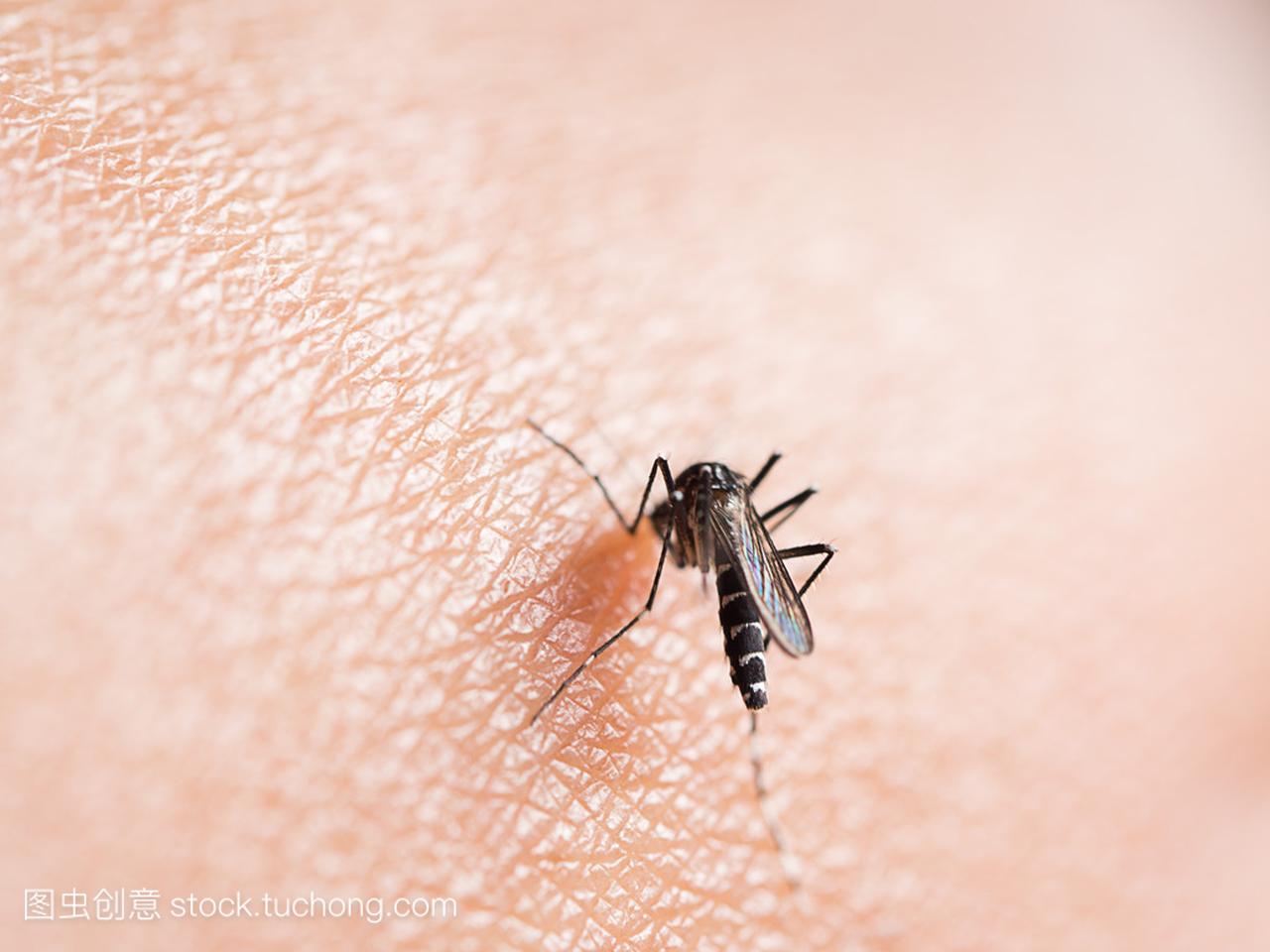 Mosquito bite on human skin (selective focus)