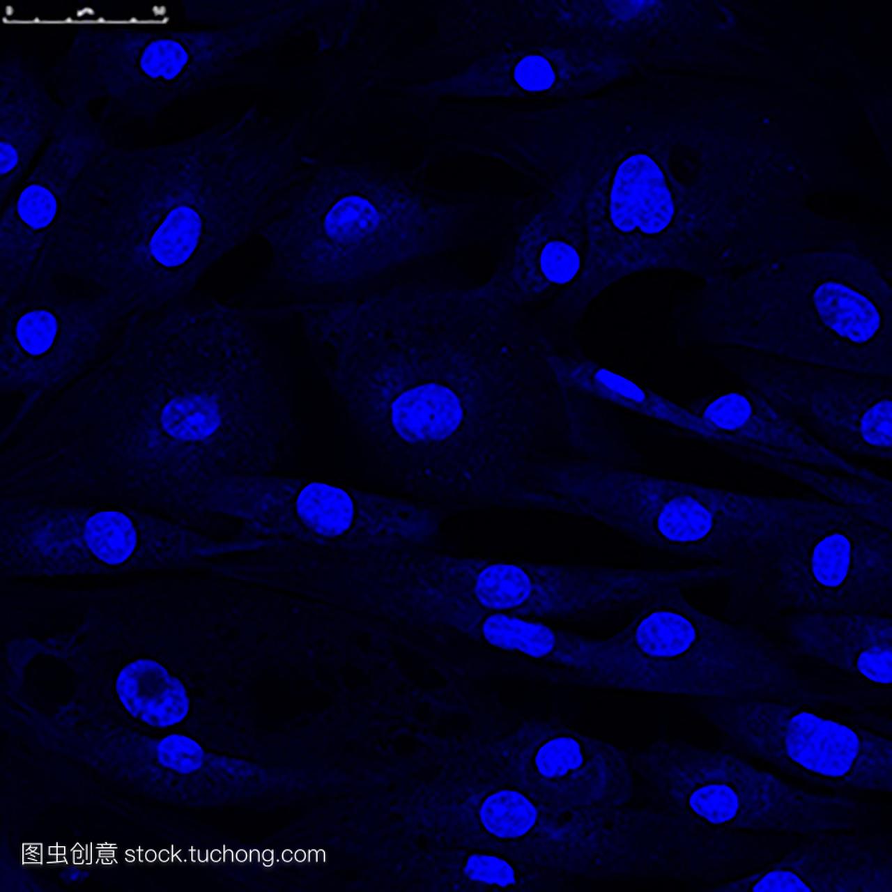 成纤维细胞细胞核共焦显微镜检查
