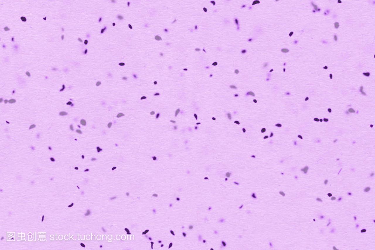 彩色化学粉红色流体中的显微镜下的细菌或细菌