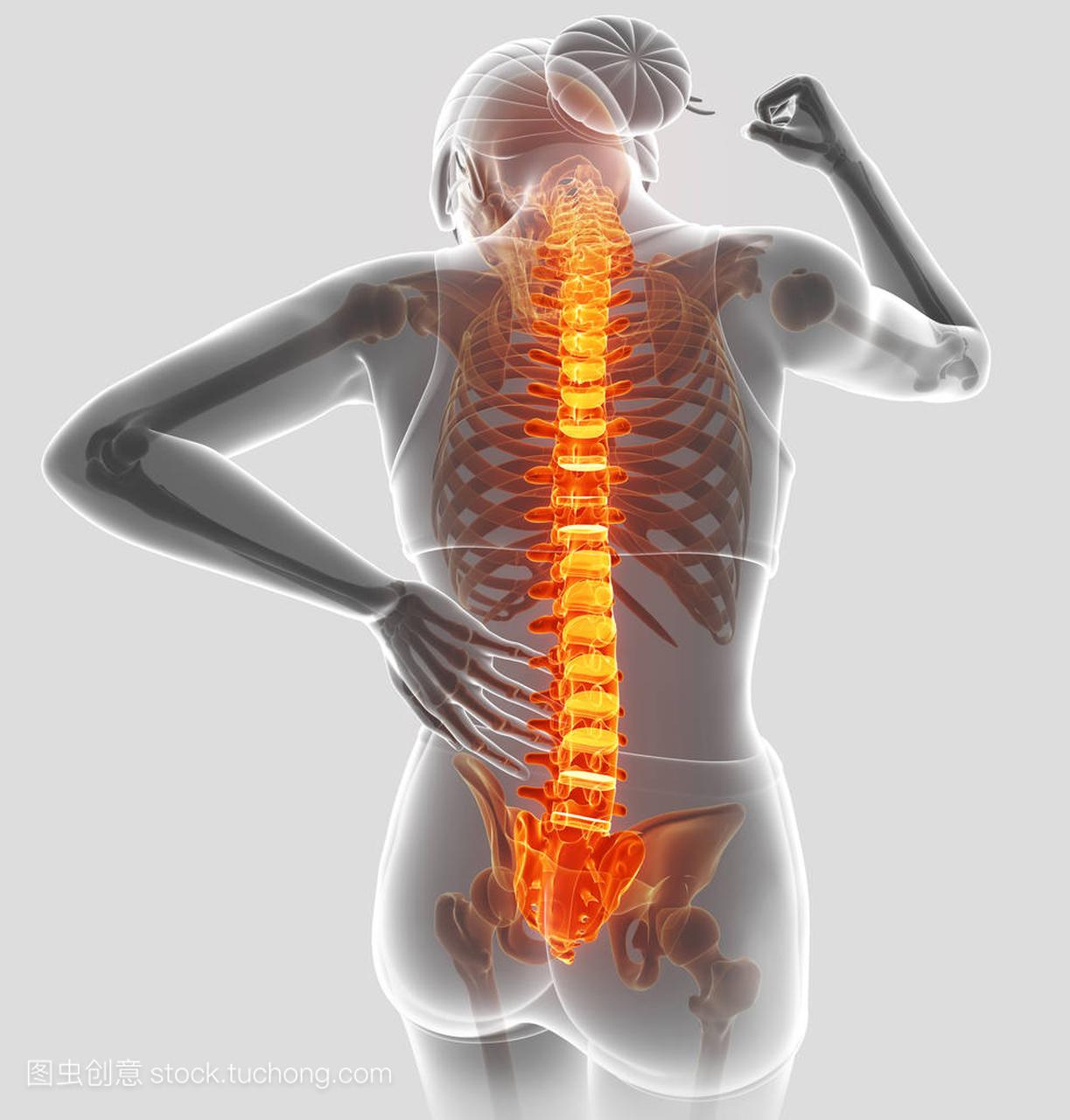 3d 插图的女性感觉背部疼痛