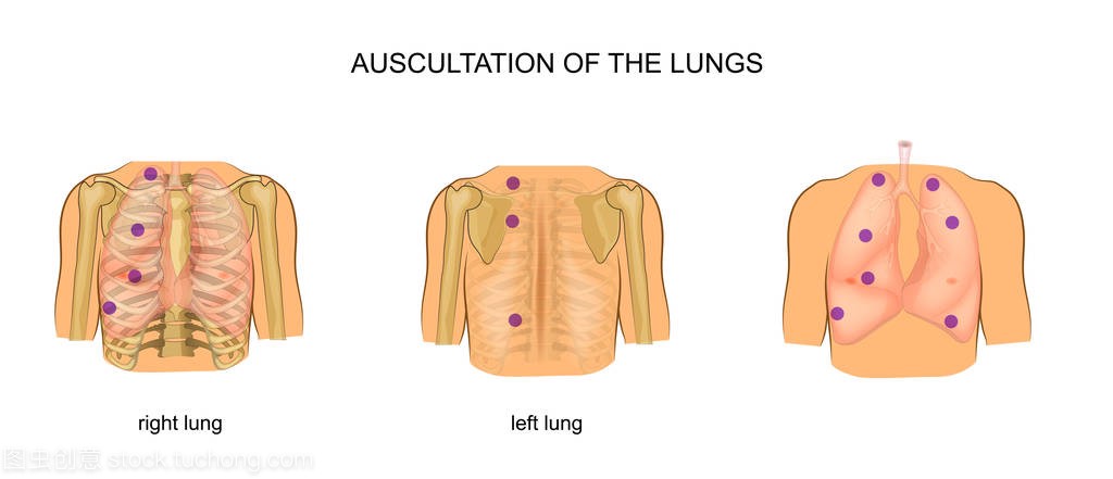 肺听诊