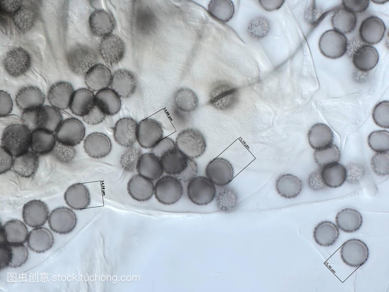 粘液霉菌的孢子。显微镜