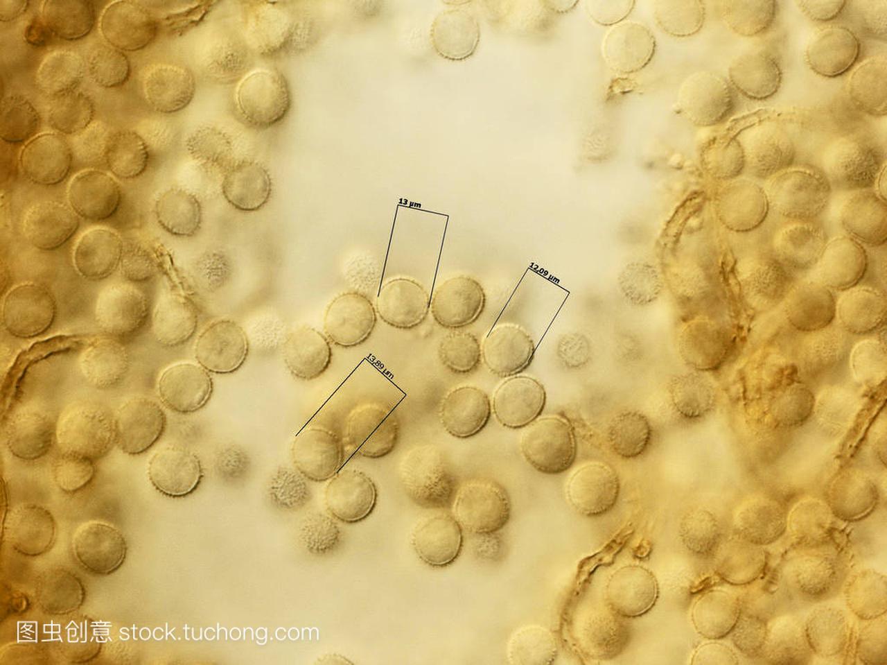 许多孢子的粘液霉菌。显微镜