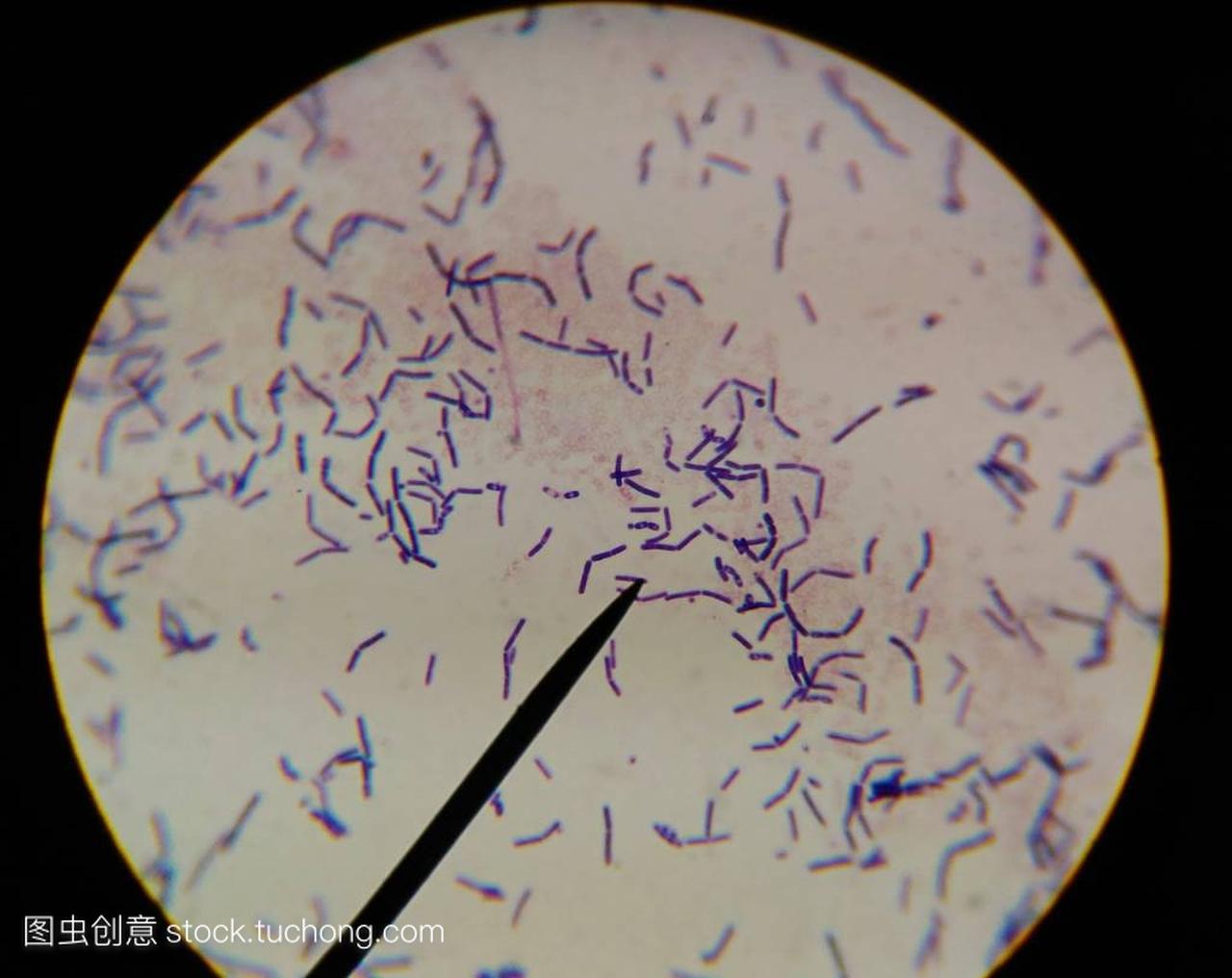 用显微镜发现细菌细胞