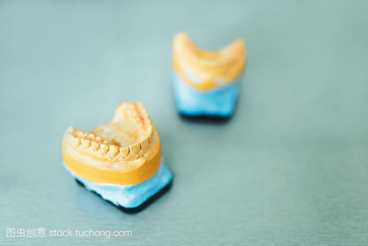 牙科用牙石膏模型的临床研究