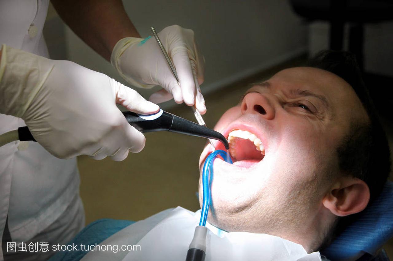 用于冲洗牙齿的牙科工具。牙齿清洁, 牙科卫生