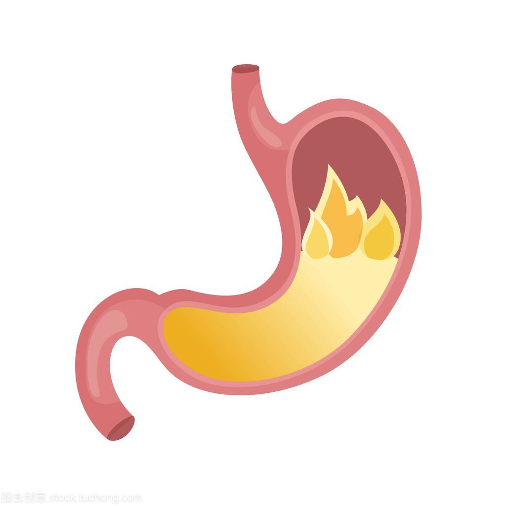 . Diseases of the stomach. Flat illustration
