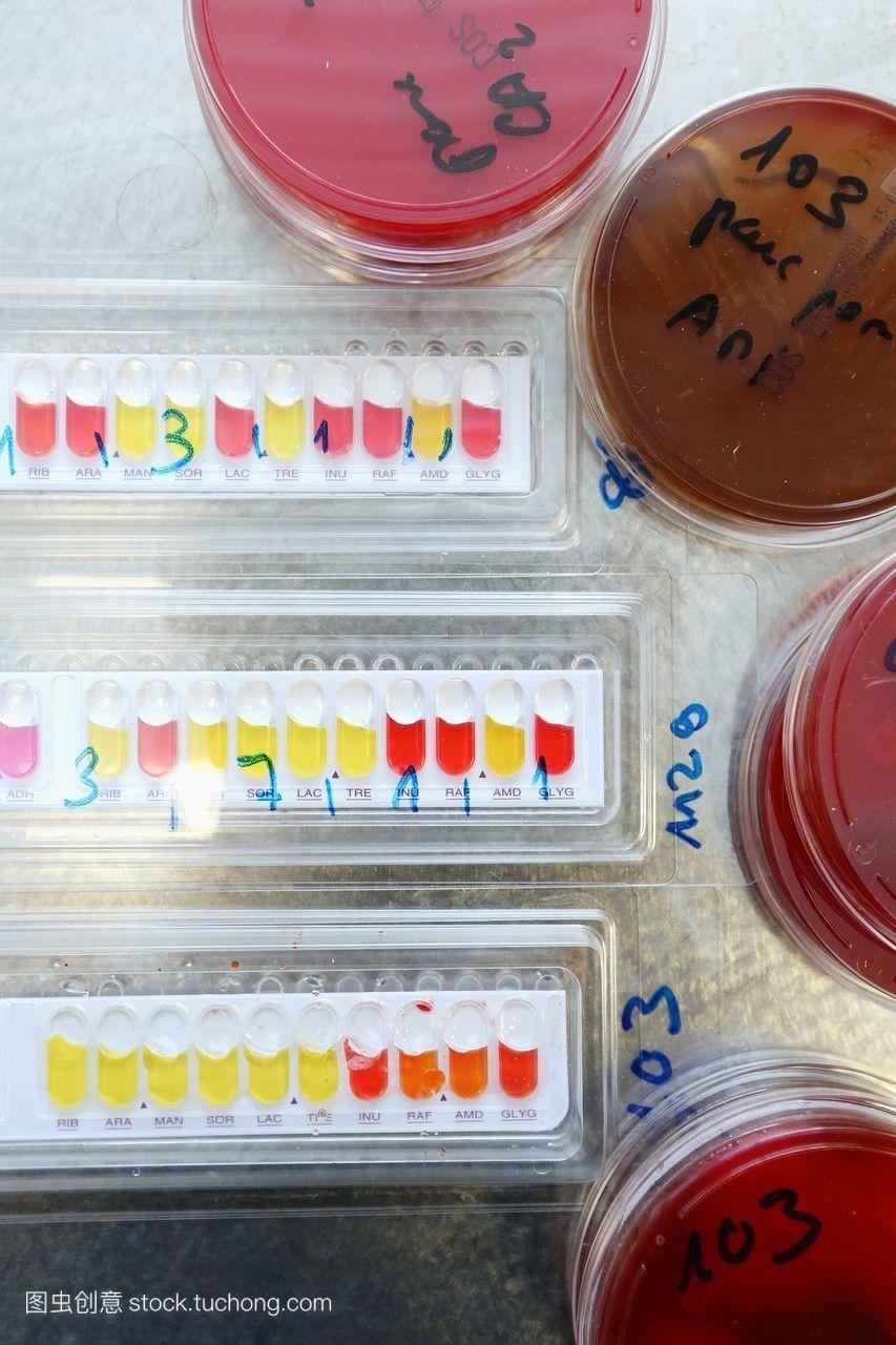 api微生物测试识别细菌实验室技术员执行一个