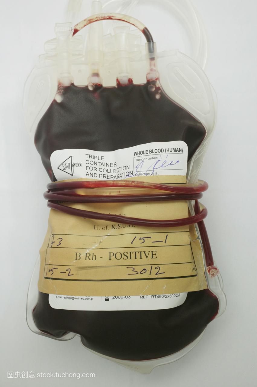 血液袋含有b+阳性血\/n\/nb+血液具有抗a抗体,目