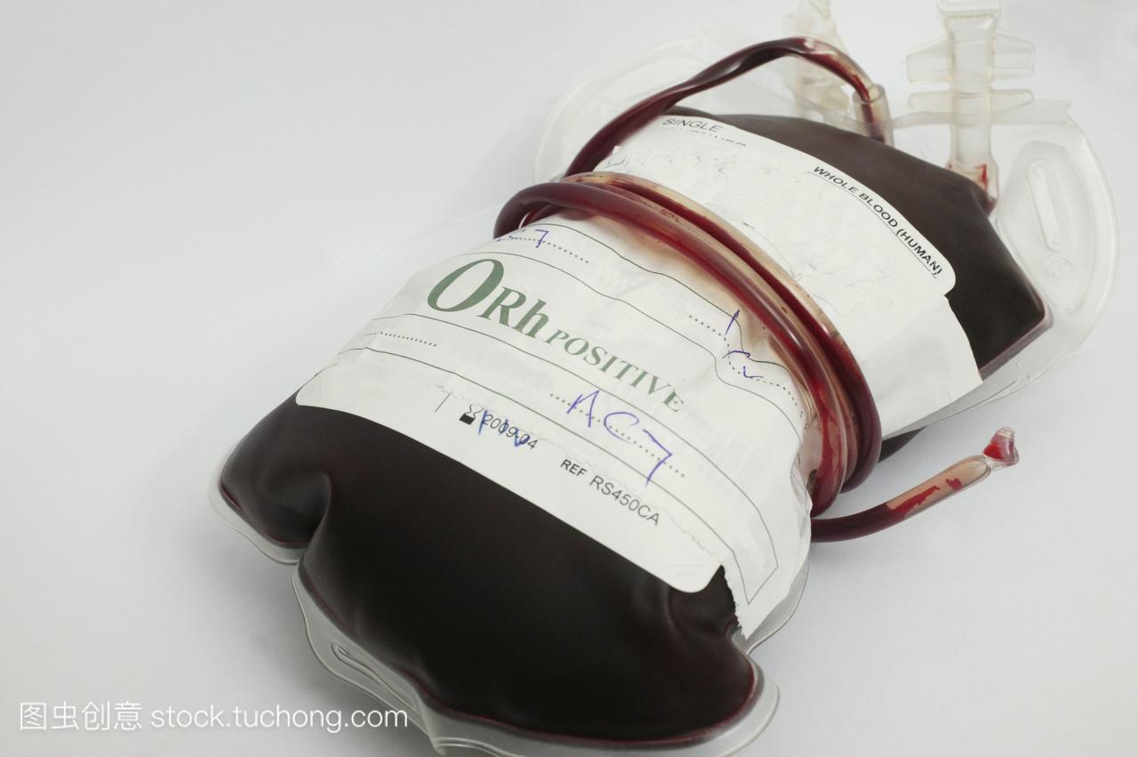 含o+阳性血\/n\/no+血液的血袋不含有抗原,同时含