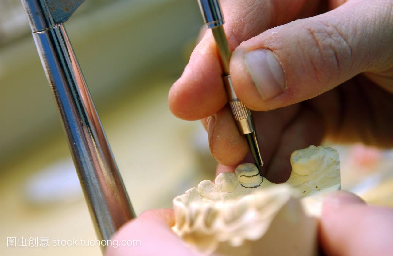 标记出一个牙科初始准备做假牙