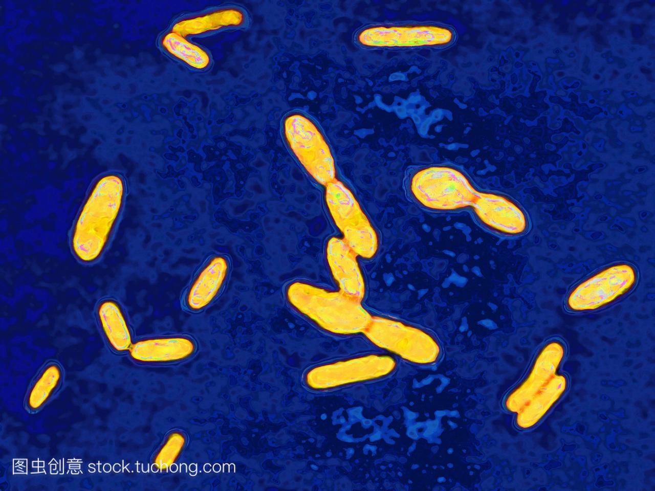 破伤风杆菌是破伤风的细菌。污染然而小伤口导