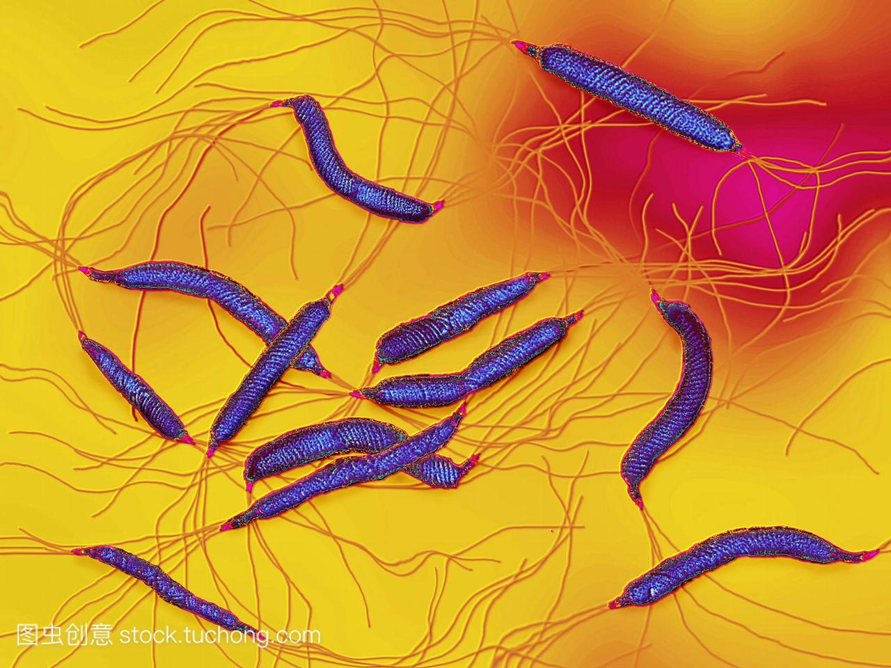 幽门螺杆菌也引起其他几个或多或少的严重疾病
