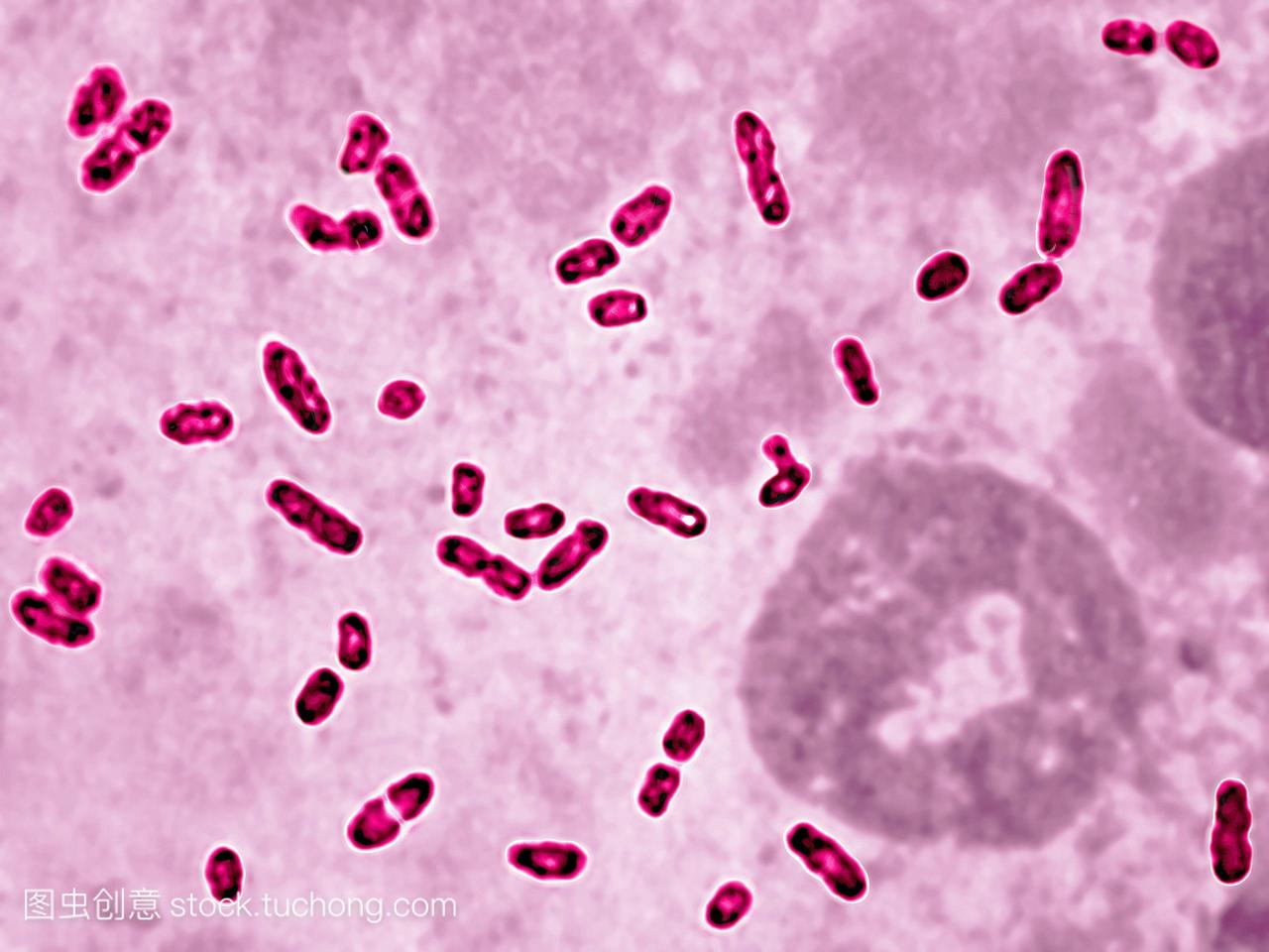 鼠疫杆菌是一种对黑死病负责的细菌。光学显微