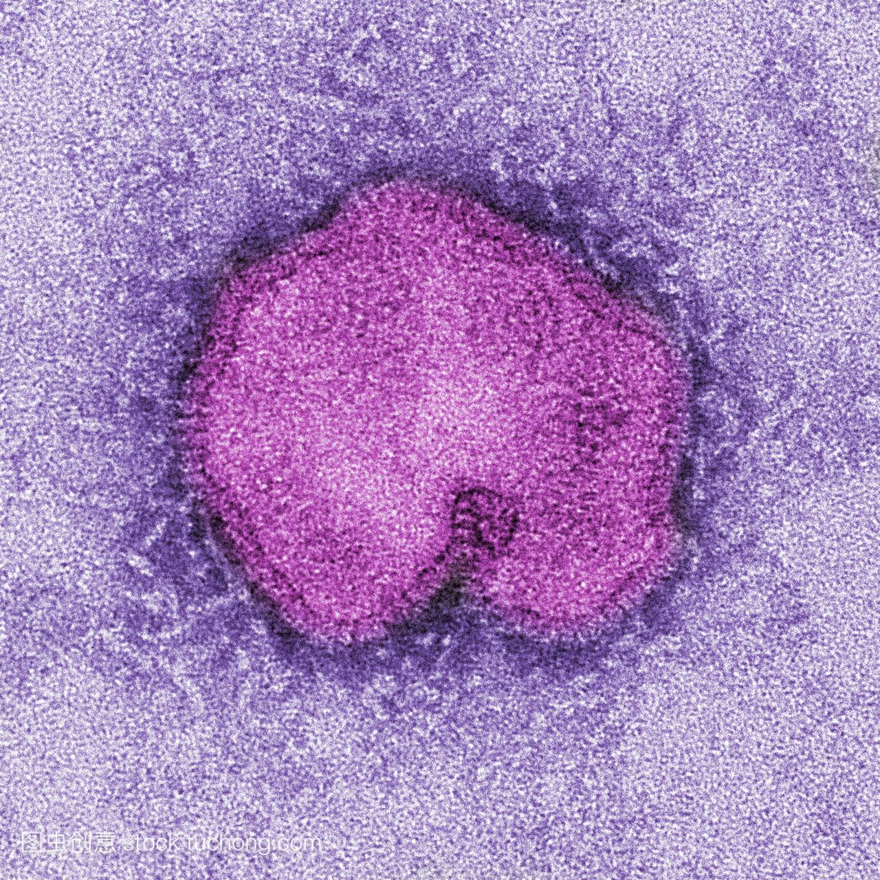 显微照片tem捕捉到了新的甲型流感病毒h7n9病