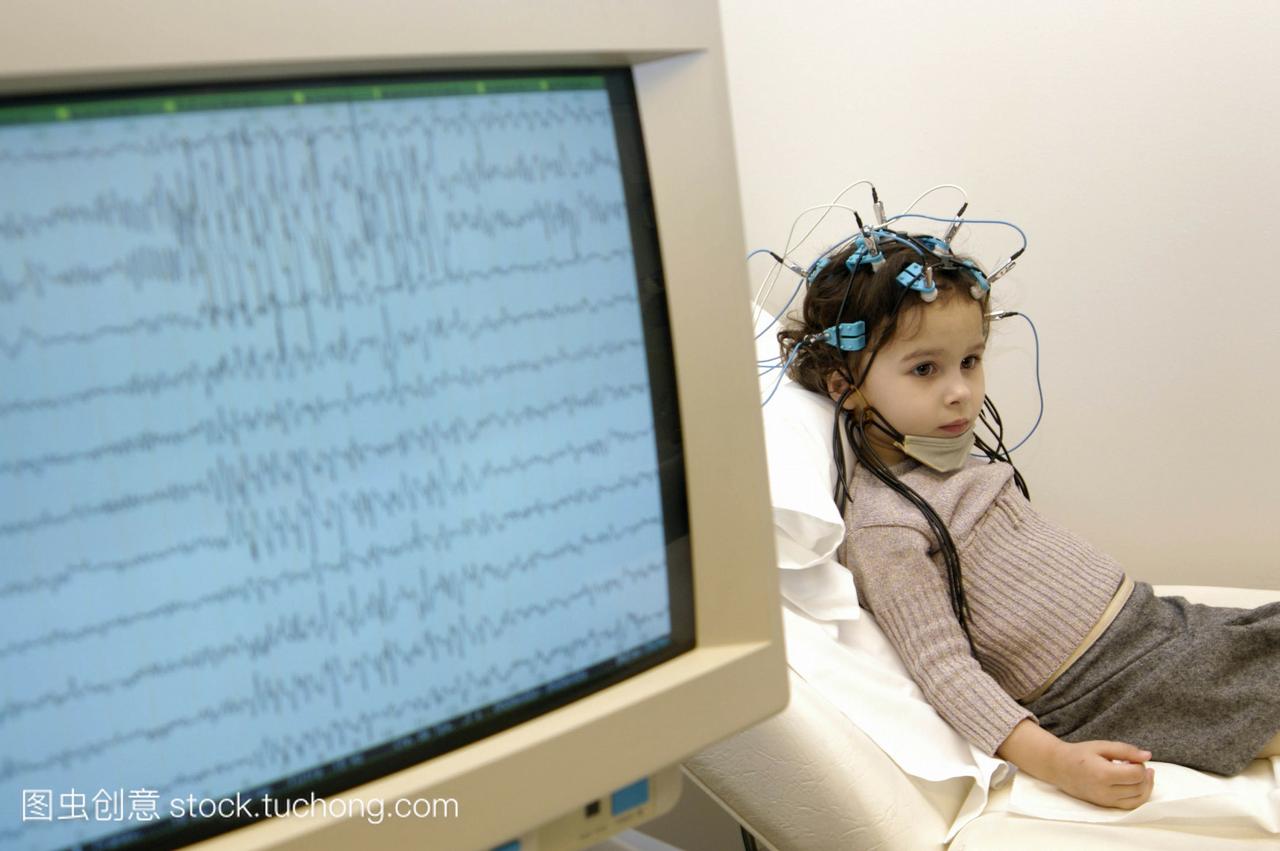 脑电图eeg对一个4岁的女孩。在屏幕上追踪癫