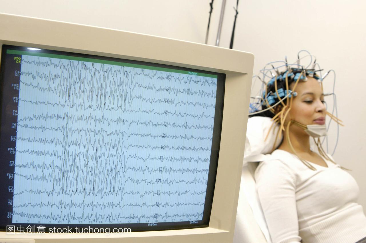 脑电图eeg对一个27岁的妇女。在屏幕上追踪癫