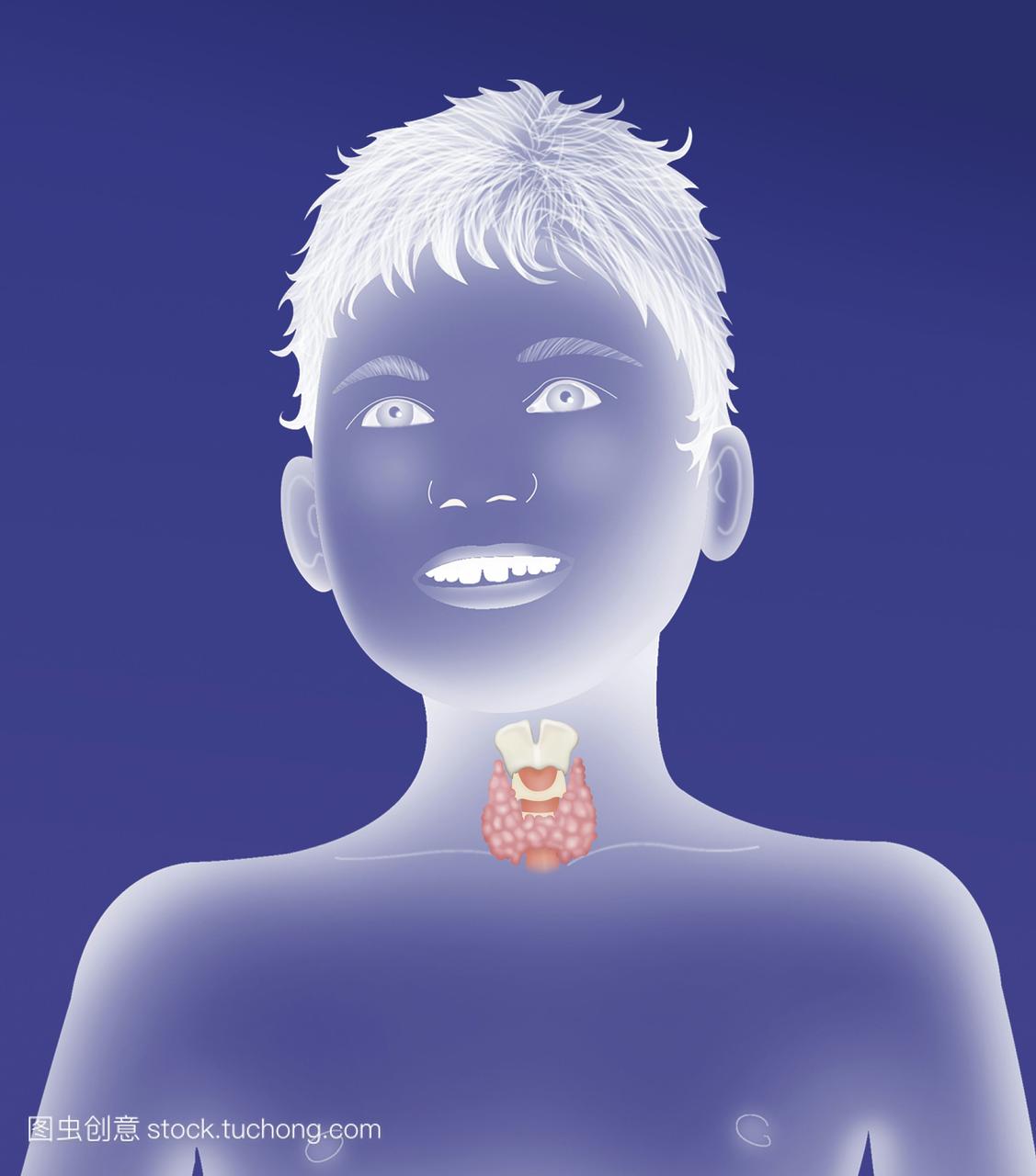 子喉咙甲状腺正常艺术品侧视人孩子男人男孩医