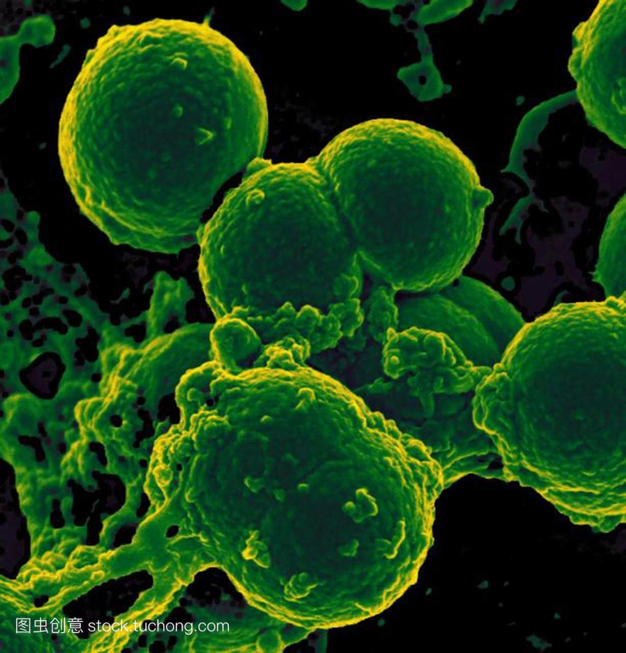 细胞和耐甲氧西林金黄色葡萄球菌mrsa细菌