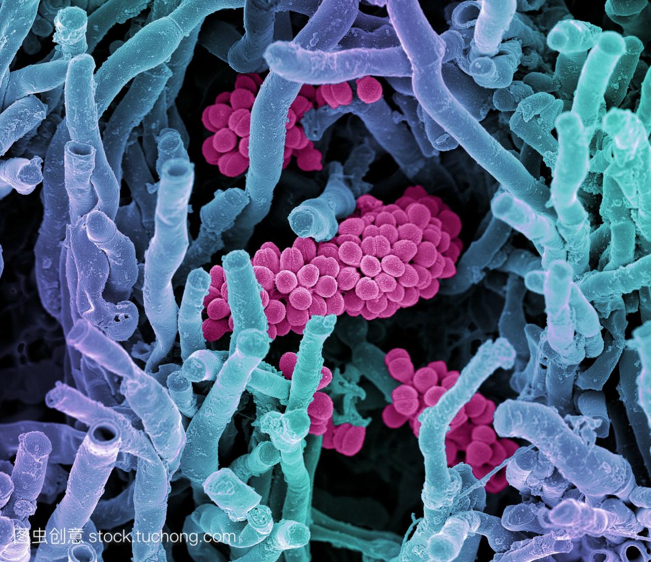 链霉菌属coelicoflavus细菌。彩色扫描电子显微