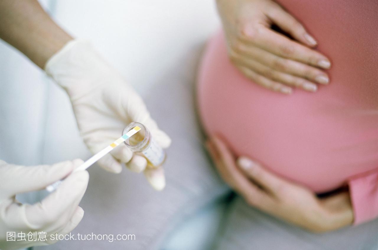 尿液常规检查怀孕期间进行测试蛋白质,血液,胆