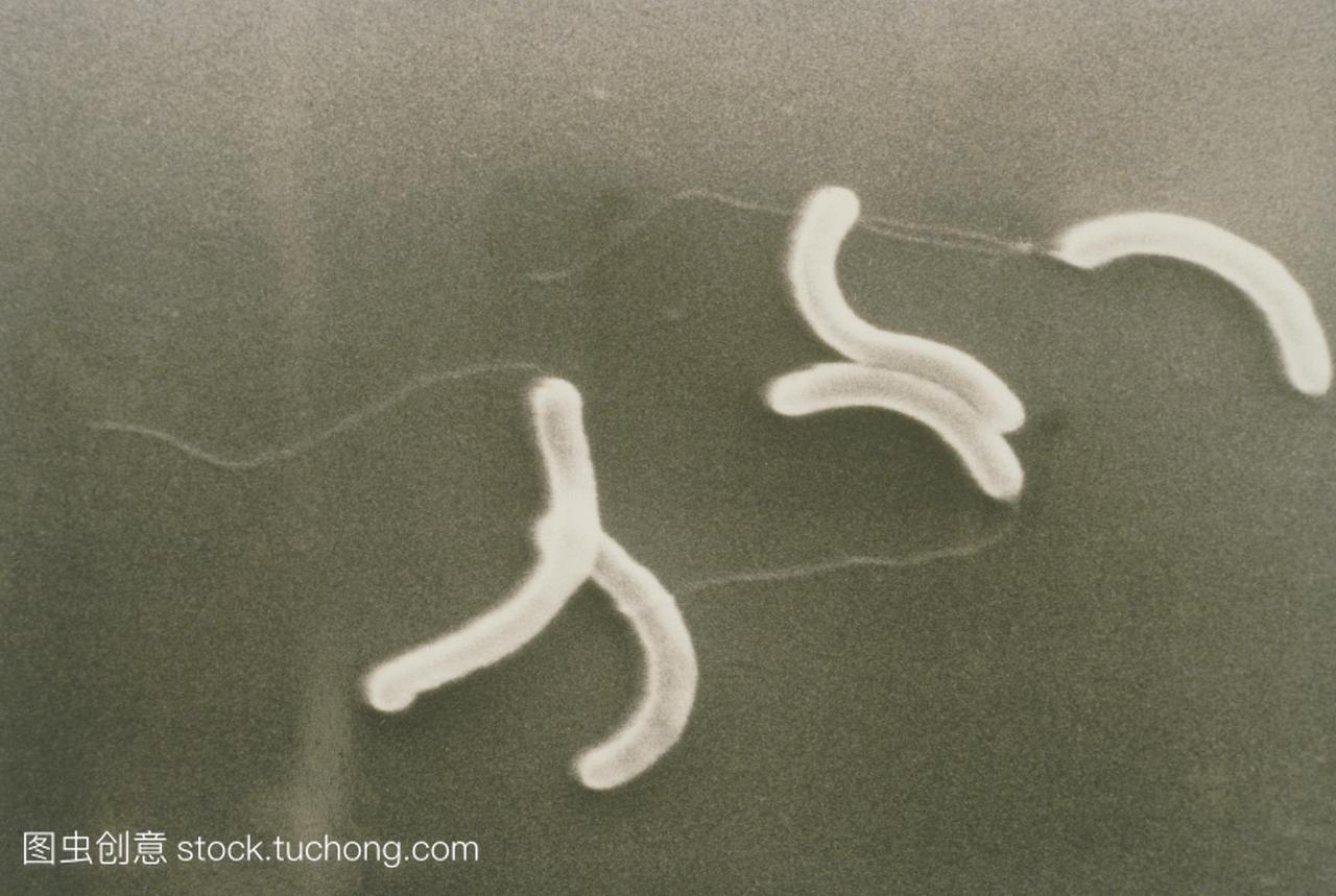 扫描电子显微图sem的逗号形状的细菌,霍乱弧