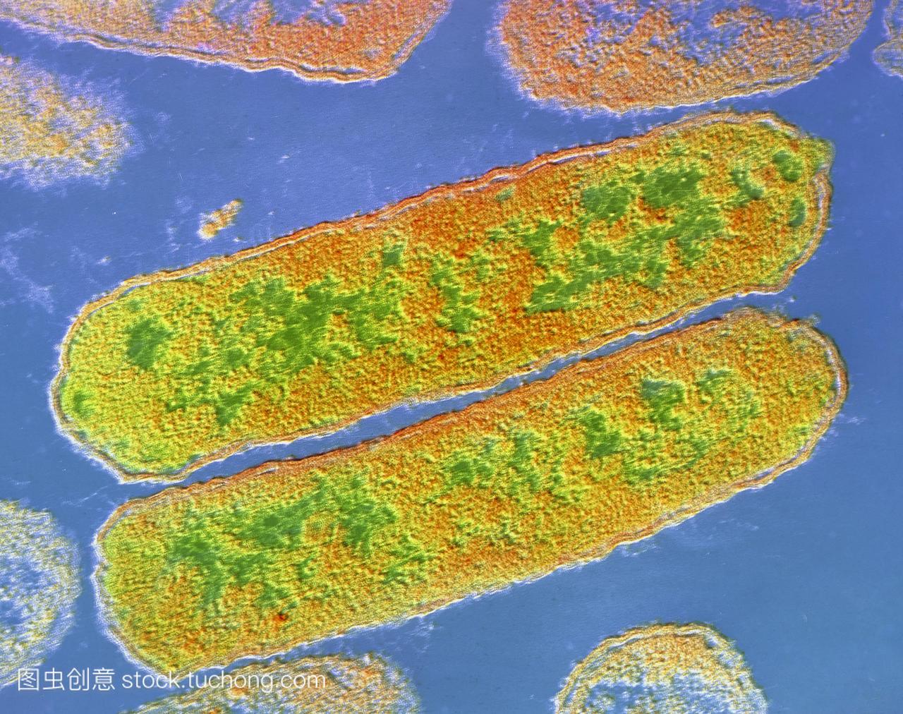 流感嗜血杆菌的假彩色透射电镜sem个体细菌小