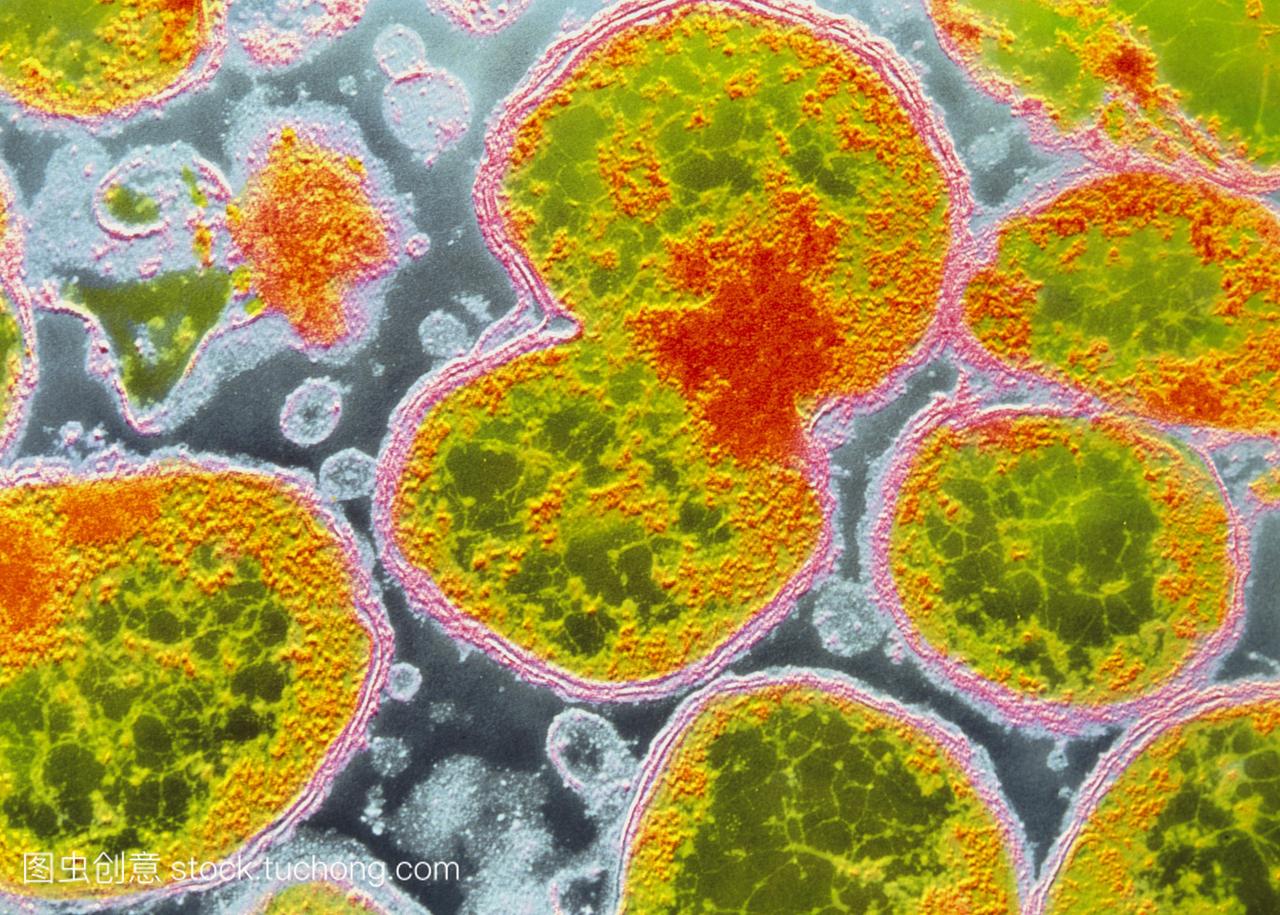 伪彩色透射电子显微照片的革兰氏阴性细菌脑膜