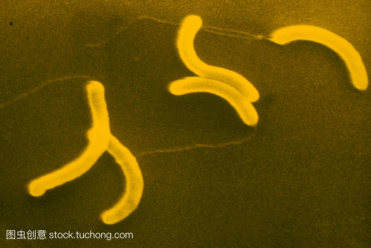 扫描电子显微照片sem,黄色,以逗号形状的细菌