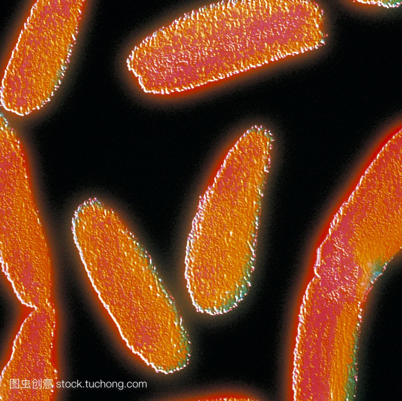 炭疽细菌。彩色透射电子显微镜TEM分段炭疽