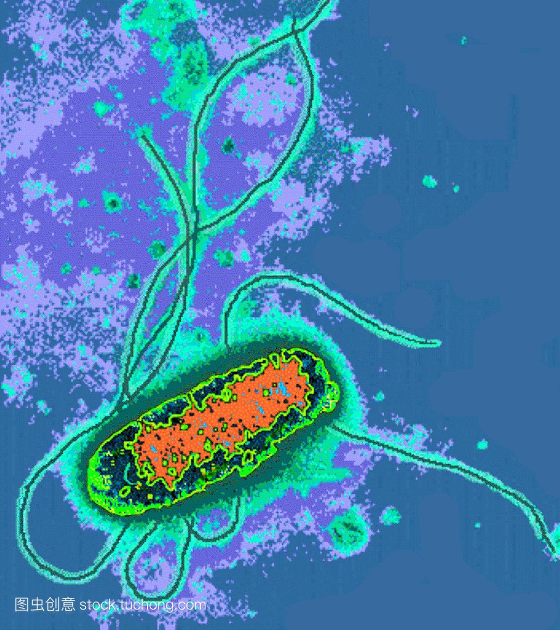 大肠杆菌。彩色透射电子显微镜tem通过大肠杆菌。大肠杆菌是革兰阴性杆菌杆状菌。长长的鞭毛使细菌移动。大肠杆菌是人类肠道的正常居民。然而，在某些情况下，它的数量可能会增加引起感染。它会引起“旅行者腹泻”和尿路感染，如膀胱炎。大肠杆菌被广泛应用于遗传研究和基因工程。负染色。放大未知。