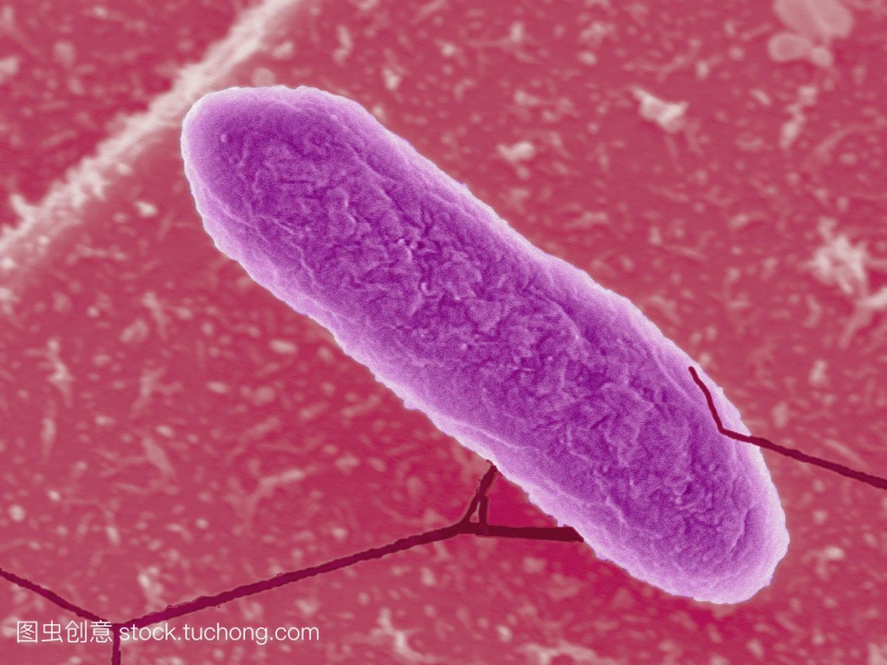 镜sem的一种plesiomonasshigelloides细菌,是人