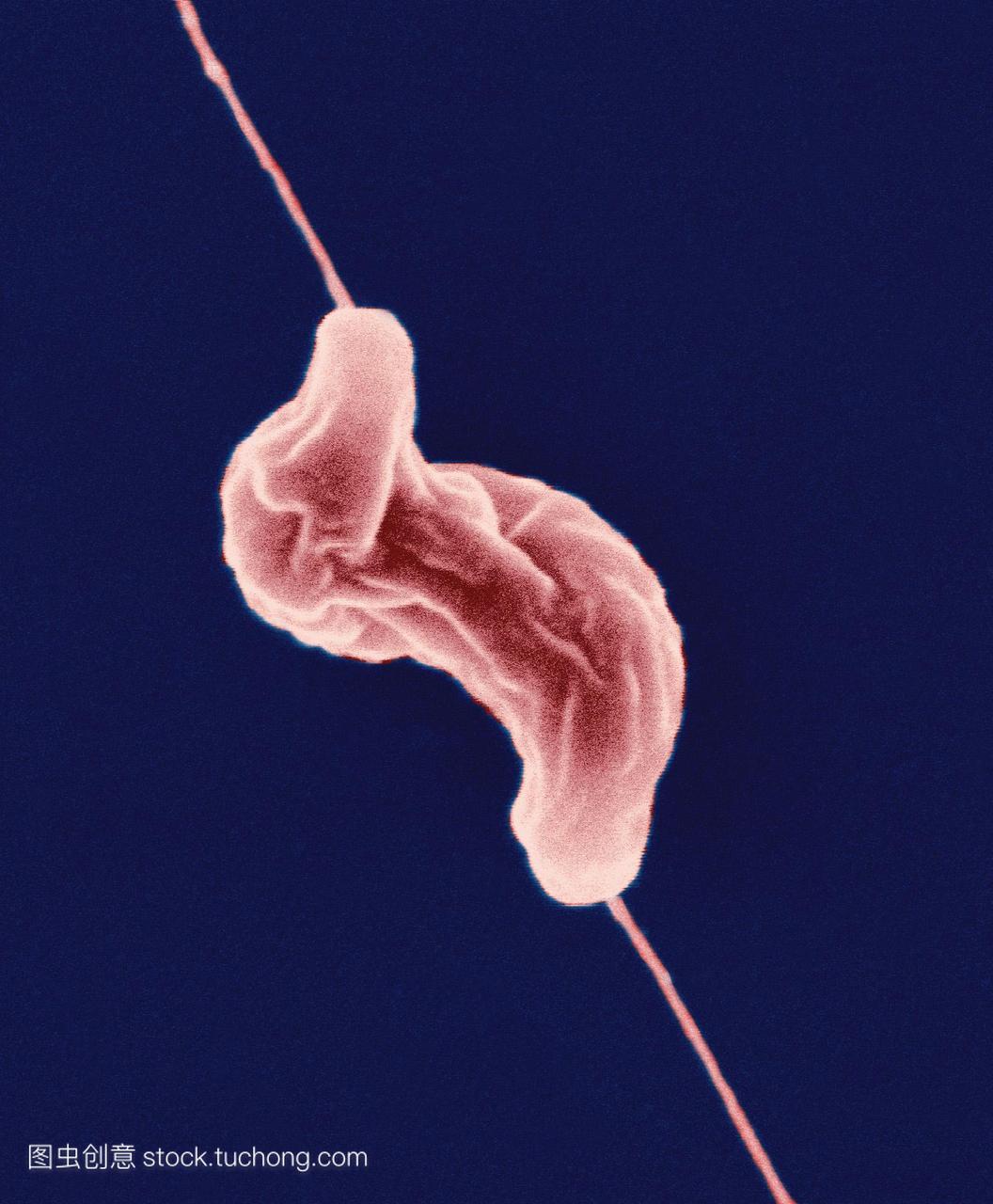 空肠弯曲杆菌细菌。彩色扫描电子显微照片se