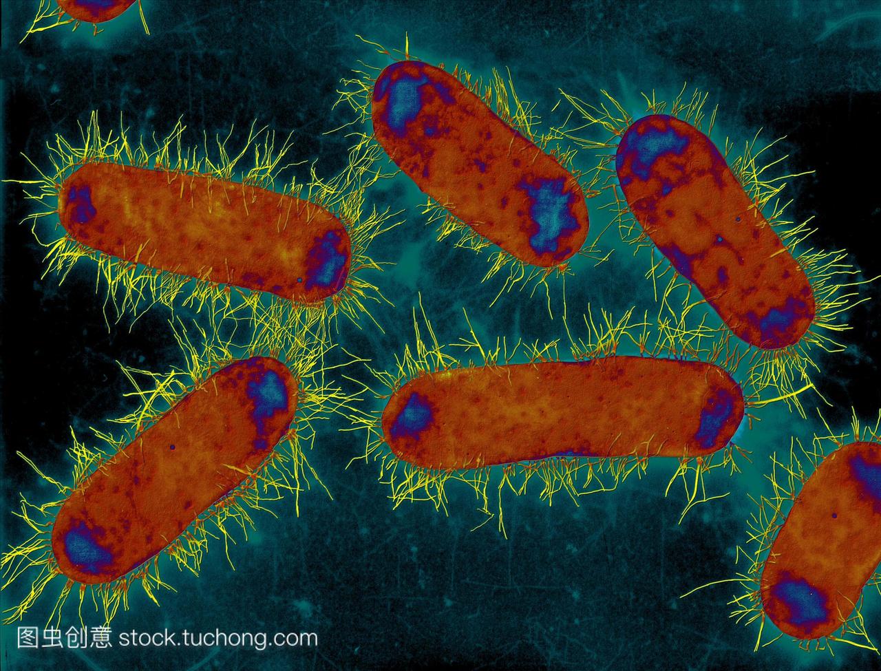 大肠杆菌的细菌。彩色扫描电子显微镜sem的杆