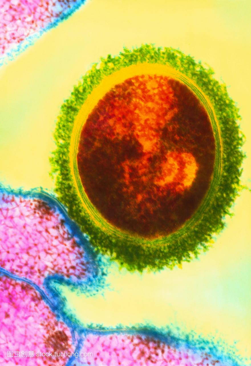 链球菌细菌A组是一个球形的革兰氏阳性球菌。