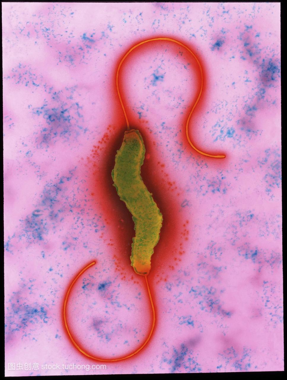 空肠弯曲杆菌。彩色透射电子显微摄影空肠弯曲