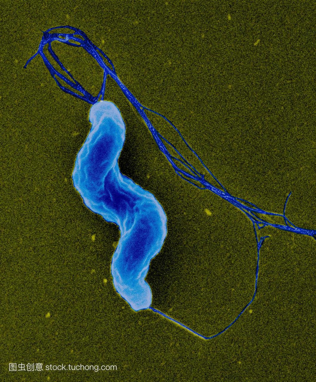 空肠弯曲杆菌细菌。彩色扫描电子显微摄影SE