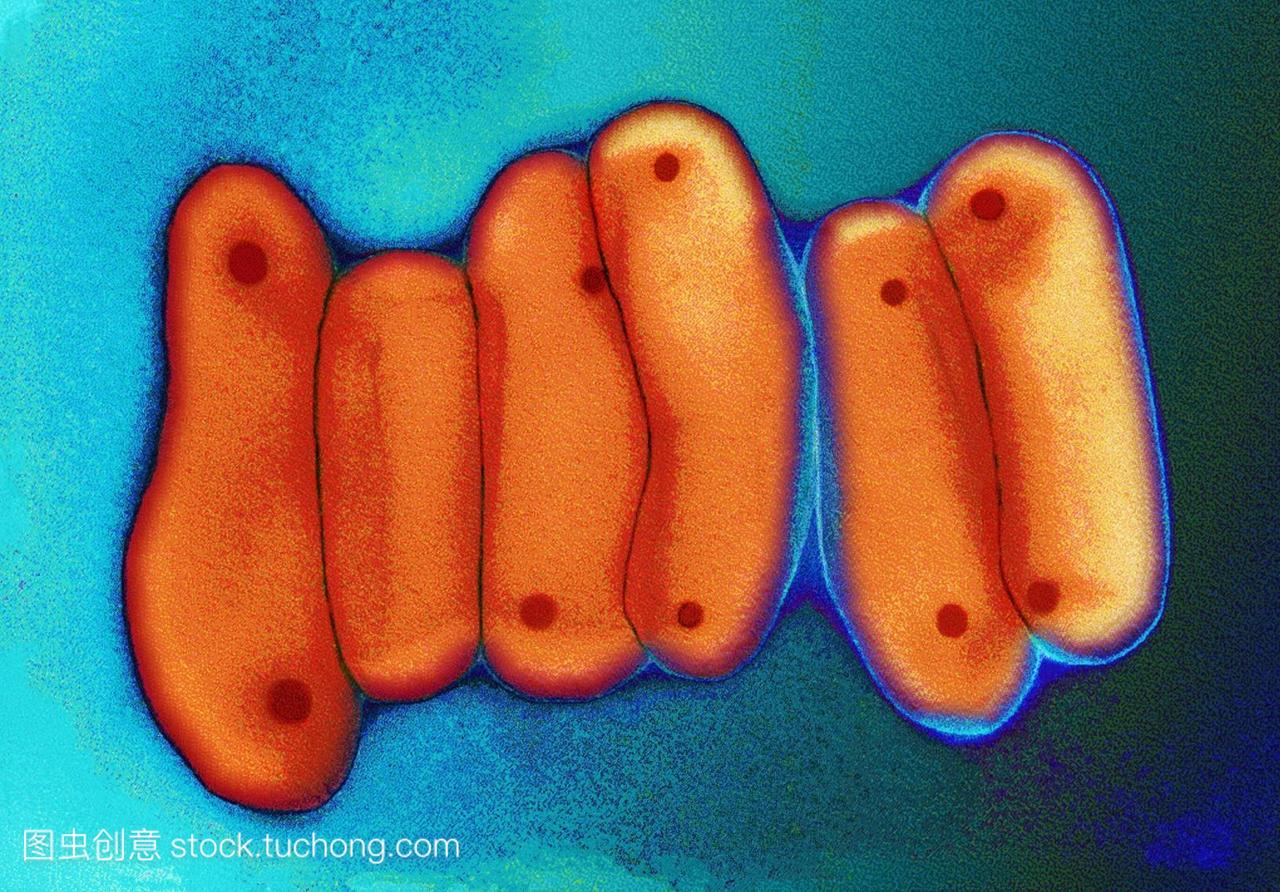 氏阳性杆状细菌是人类结核病TB的主要原因。
