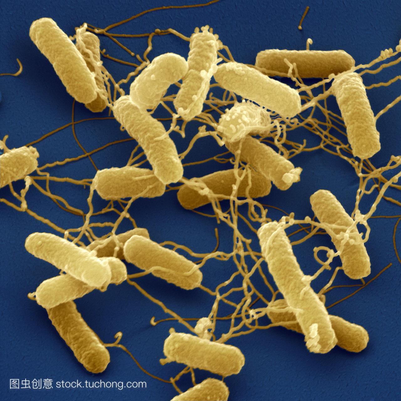 沙门氏菌，彩色扫描电子显微镜sem。这些细菌，也被称为沙门菌，是革兰氏阴性的杆状细胞，有鞭毛毛发状结构，用于运动。美国伤寒是人类食物中毒沙门氏菌病的主要原因。沙门氏菌病最常见的是受感染的猪肉,家禽和蛋类。它也可能是由家庭宠物传播的。症状包括发烧,发冷,严重腹泻和呕吐。它可能是致命的，在非常年轻的，老年人和个人免疫系统下降。用抗生素治疗。