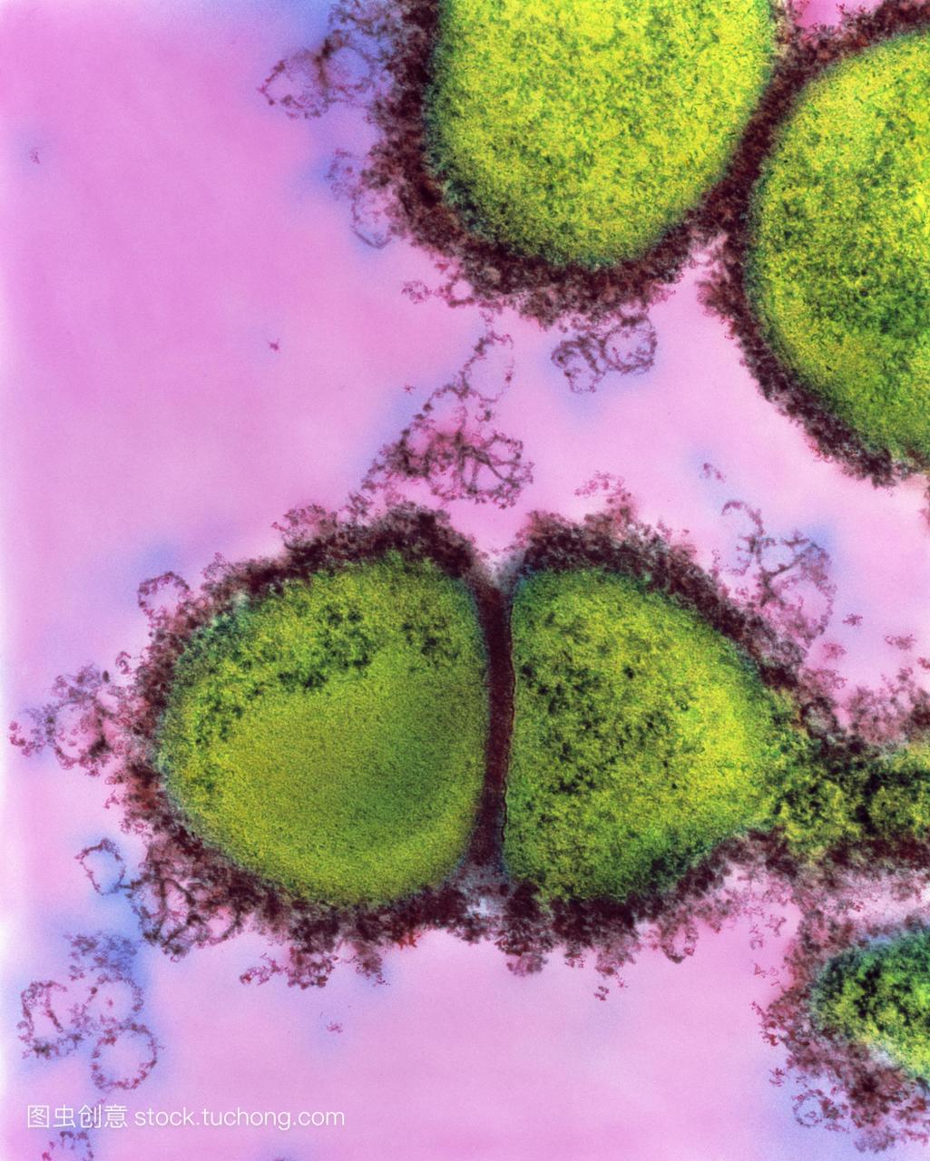 酿脓链球菌细菌。彩色反式-任务电子显微镜TE