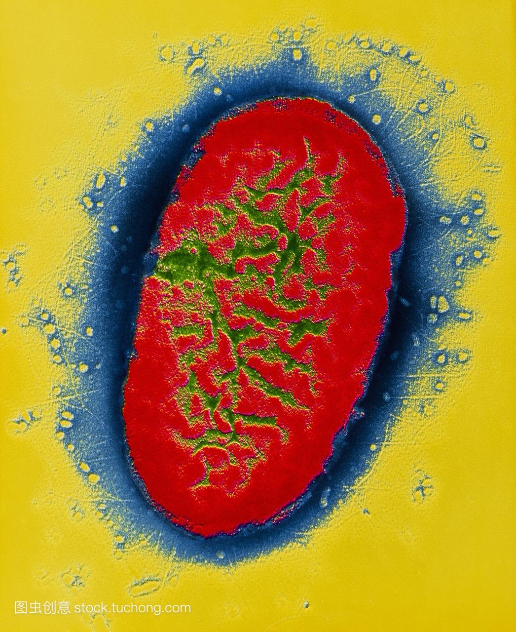 百日咳杆菌的假彩色透射电子显微照片。该微图