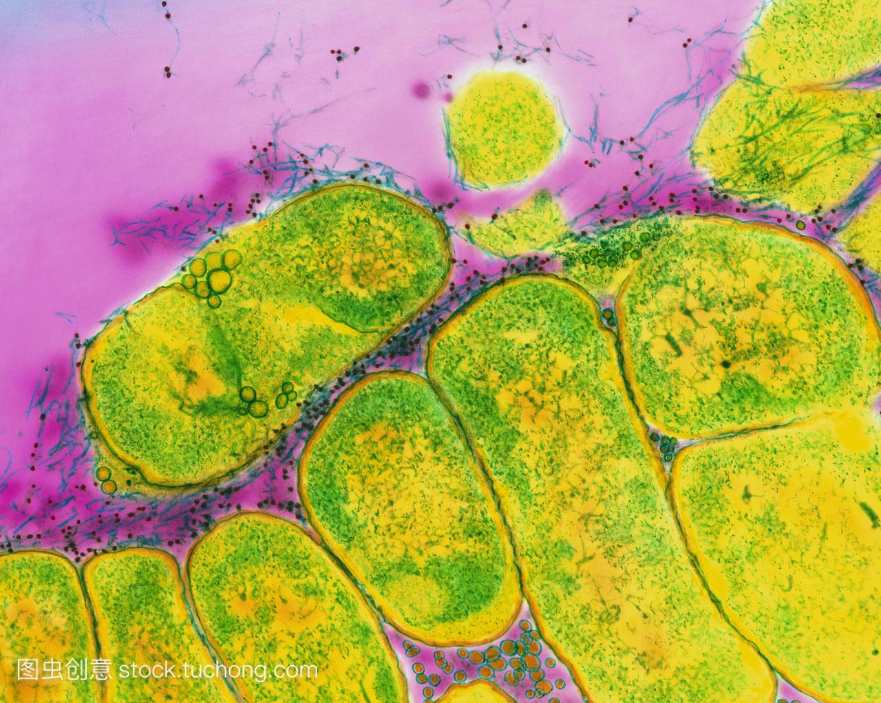 放线杆菌属细菌。彩色透射电子显微镜TEM的