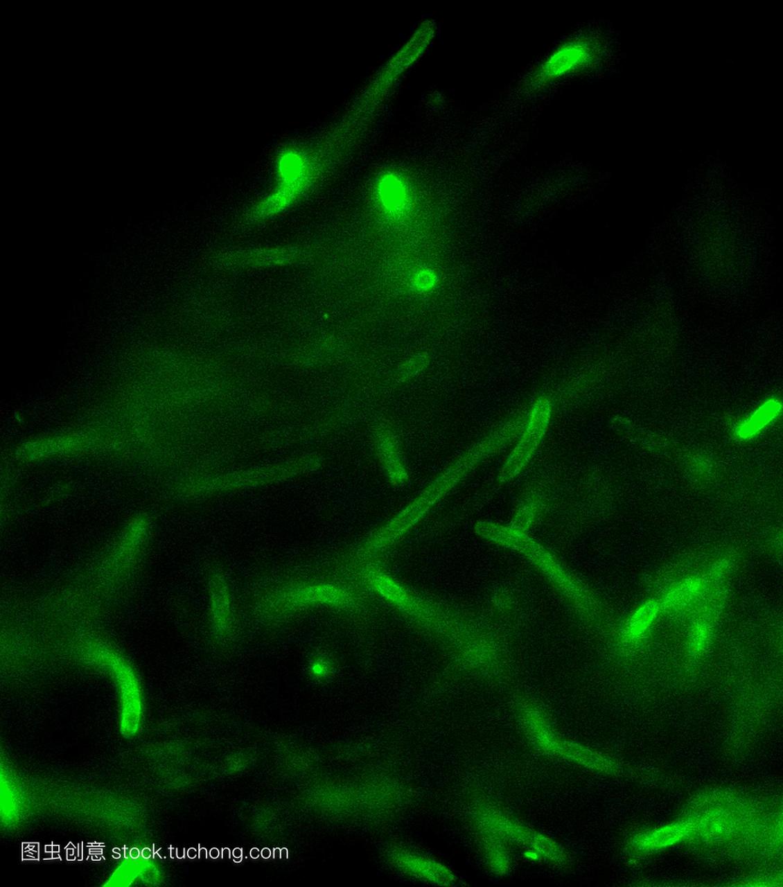 炭疽细菌。炭疽杆菌细菌的荧光显微照片炭疽热