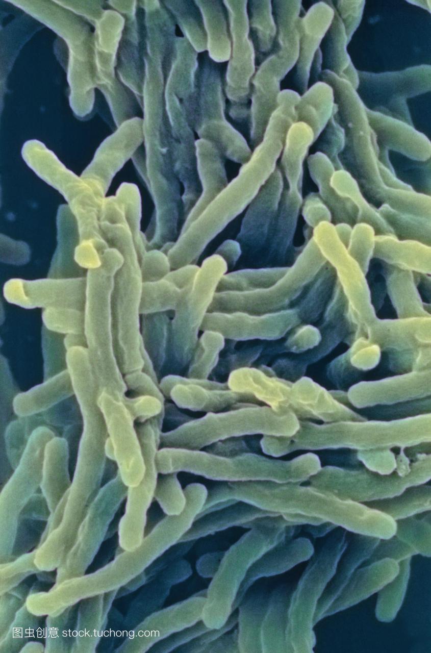 M结核分枝杆菌的细菌人类结核病的主要原因。